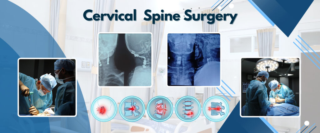 Cervical Spine Surgery